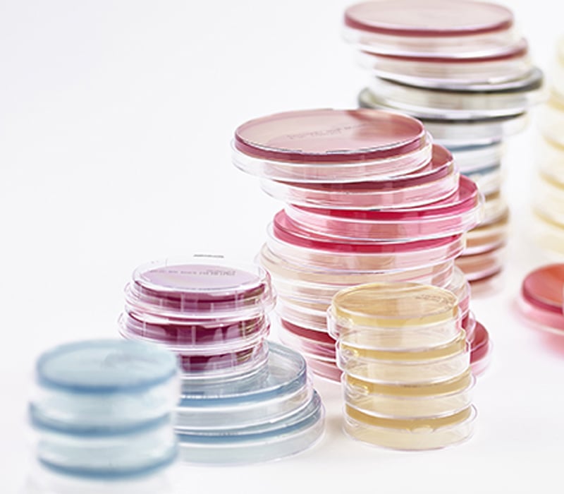 Growth Media Type R2A agar